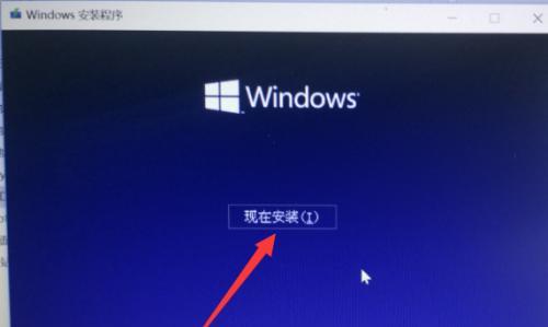 使用U盘安装Win10系统的详细步骤（简单易懂的安装教程）